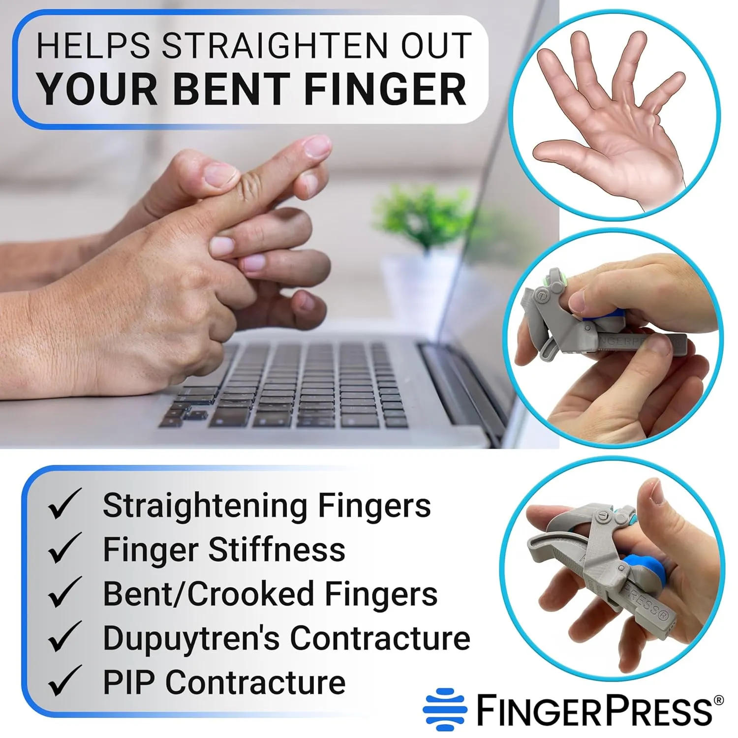 Finger Straightener | PIP Extension Orthosis/Splint For Bent Fingers, PIP Flexion Contractures | Adjustable Joint Stretcher Device | Made in USA | Purple/Large